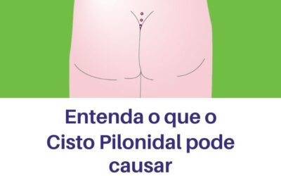 O que o cisto Pilonidal pode causar?