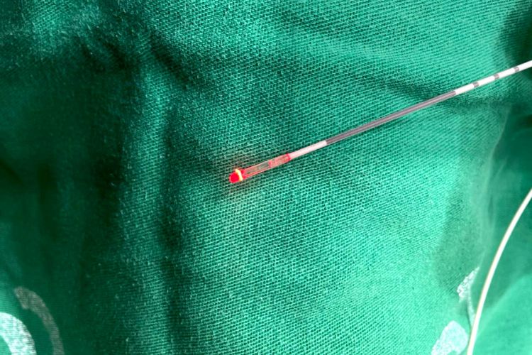 Conheça o tratamento de fístula anal com laser