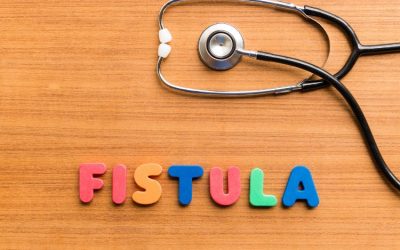 Fístula, o que é?