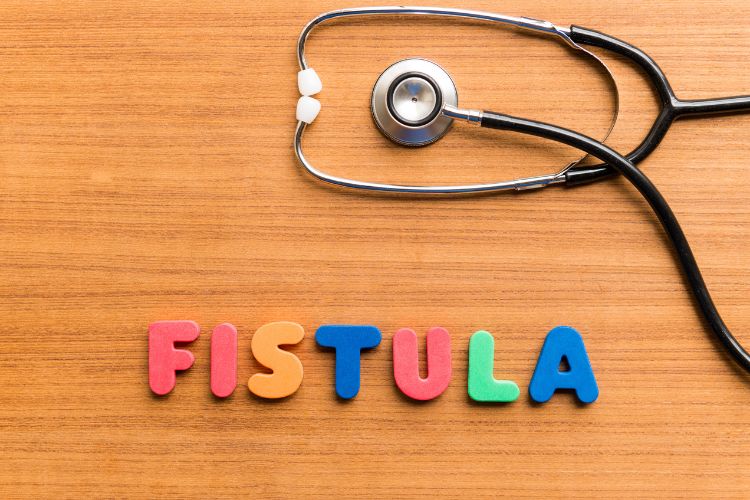 Fístula, o que é?