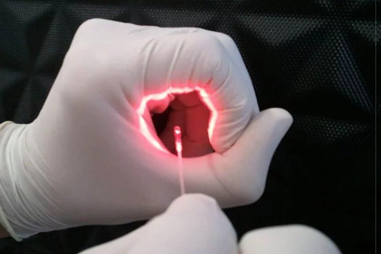 6 abordagens da coloproctologia minimamente invasiva
