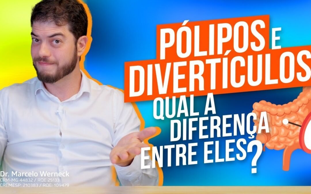 Crise de Diverticulite: Sintomas, Sinais de Alerta e Quando Procurar Atendimento