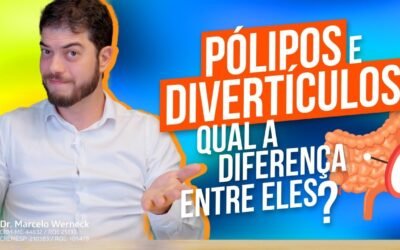 Crise de Diverticulite: Sintomas, Sinais de Alerta e Quando Procurar Atendimento