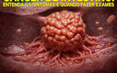 Sintomas de Câncer de Intestino: o que observar e quando investigar