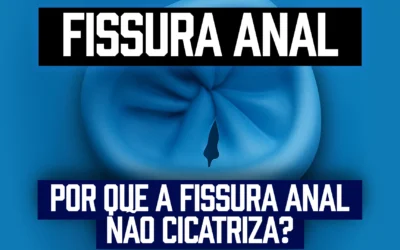 Fissura anal que não melhora com pomada: o que fazer