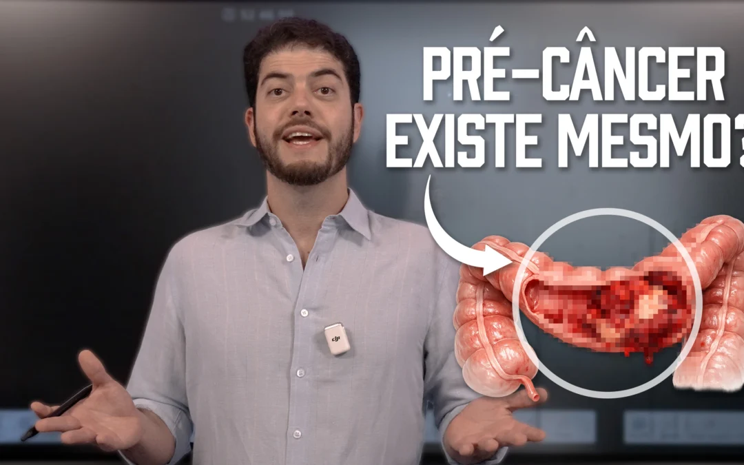 Adenoma é Câncer? Entenda o que é Pré-câncer, Alto Grau e Quando Preocupar