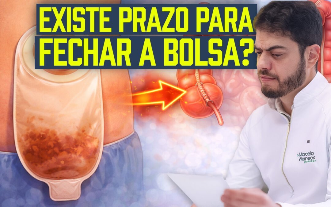 Fechamento de colostomia, pode ser feita depois de 5, 10 ou 15 anos? Entenda Quando e Como Fazer