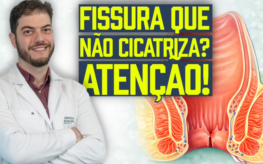 Fissura anal: Guia Definitivo com 9 sinais de fissura atípica