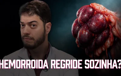 Hemorroida regride? Entenda por que quase nunca e quando parece que sim