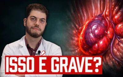 Trombose hemorroidária: o que é, por que dói e quando preocupar (Guia Completo)