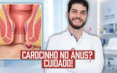 Carocinho no ânus: Saiba o que é e quando se preocupar | Dr. Marcelo Werneck
