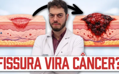 Fissura anal vira câncer? Dr. Marcelo Werneck esclarece as dúvidas