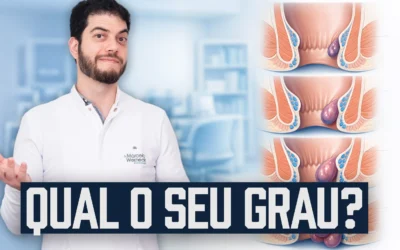 Graus de hemorroidas: Conheça os tipos e como tratar | Dr. Marcelo Werneck