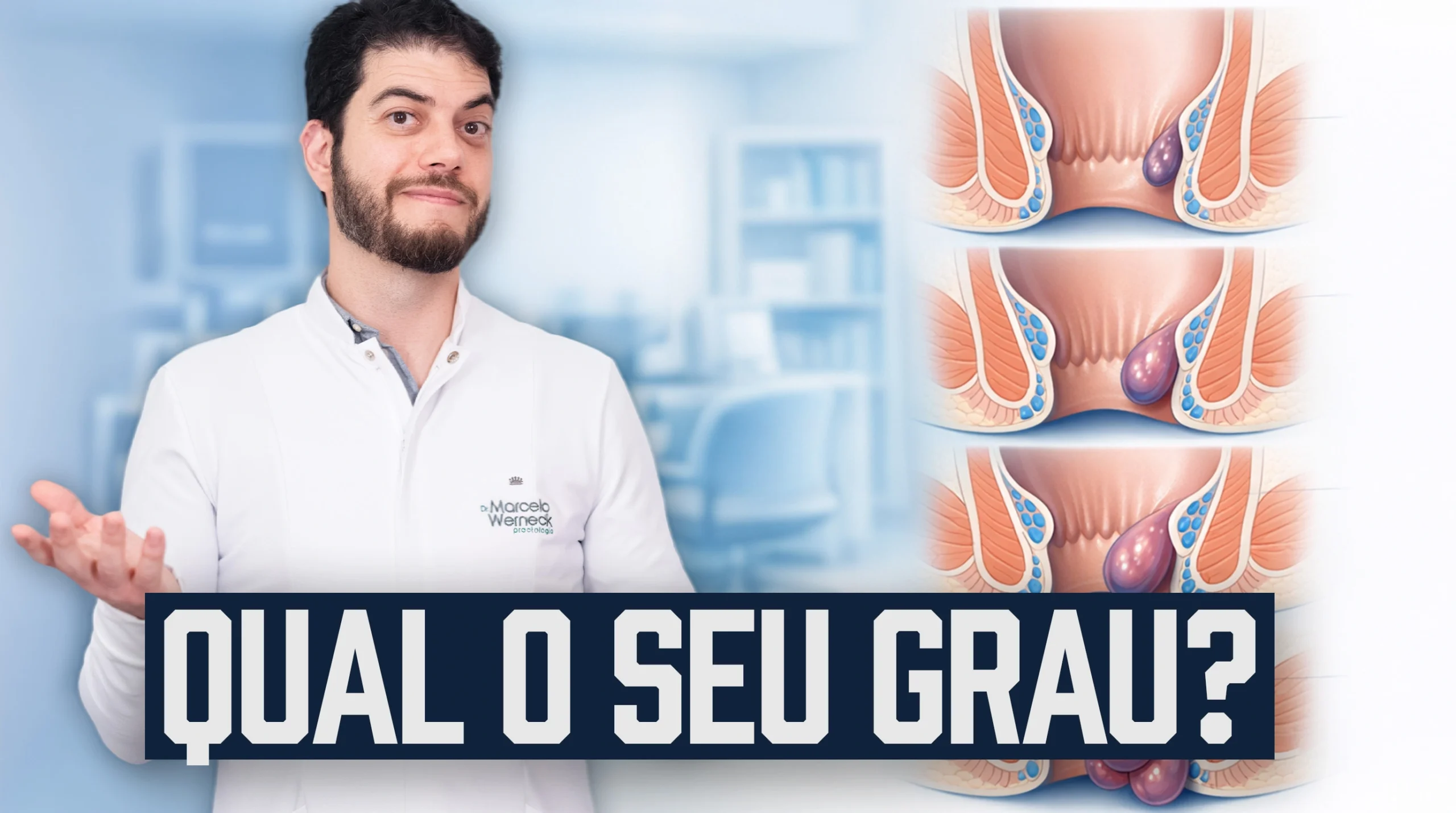 Quando tratar a hemorroida conforme o grau: classificação de grau 1 a 4
