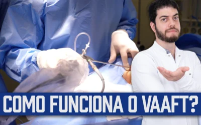 Cirurgia de fístula por vídeo (VAFT): Como funciona? | Dr. Marcelo Werneck