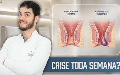 Por que a hemorroida volta sempre? Dr. Marcelo explica
