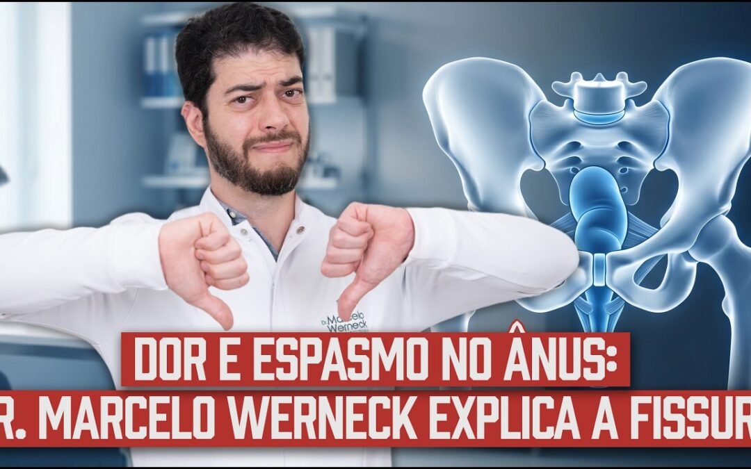 Fissura Anal: Por Que a Dor Piora 30 Minutos Depois de Evacuar?