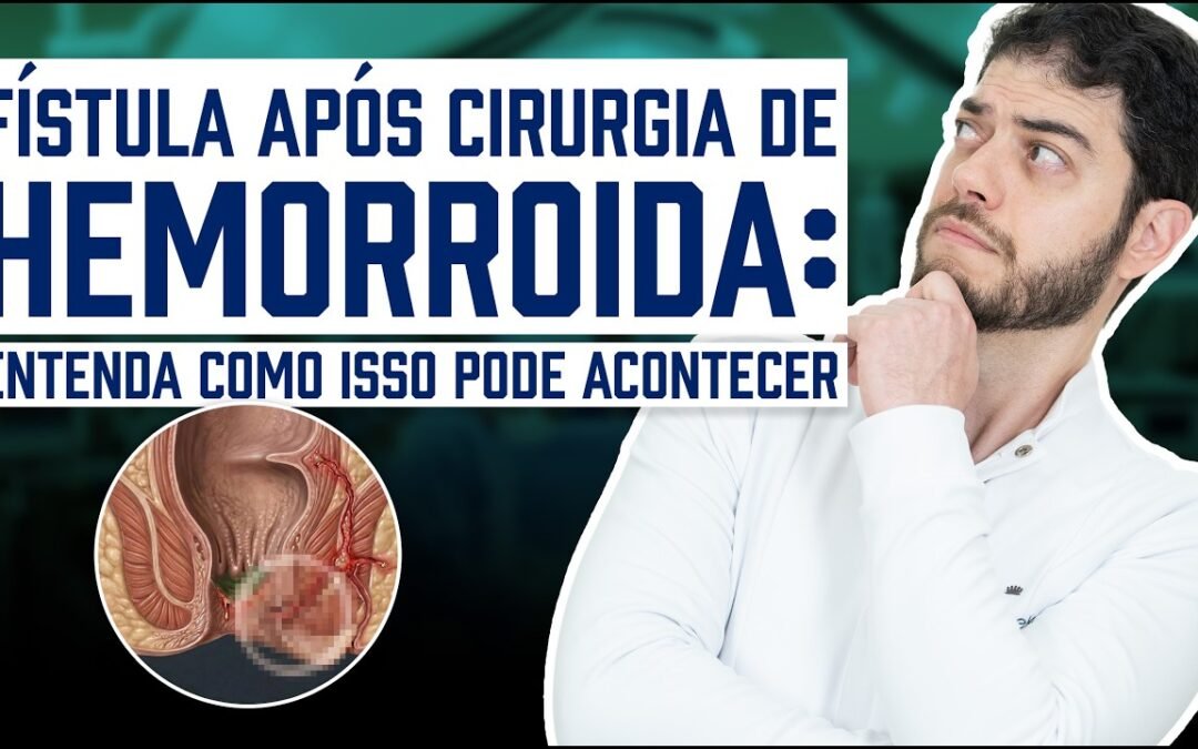 Fístula Após Cirurgia de Hemorroida: Por Que Acontece e Como Tratar