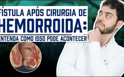 Fístula Após Cirurgia de Hemorroida: Por Que Acontece e Como Tratar