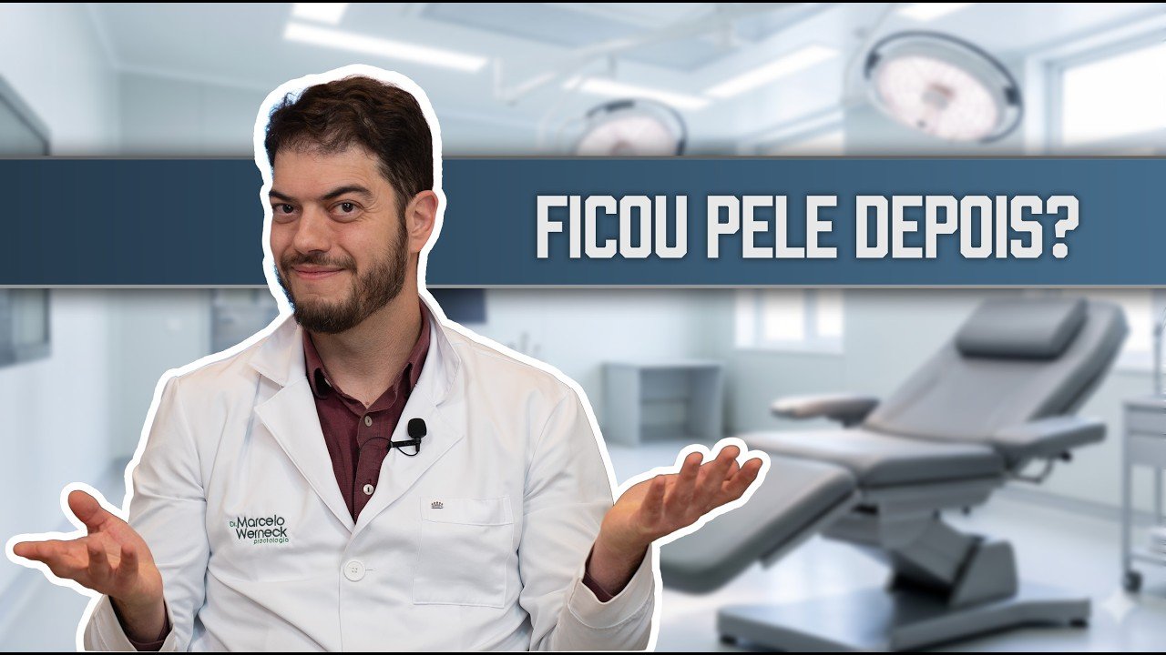 operei de hemorroida e ficou uma bolinha operei de hemorroida e ficou uma bolinha — Dr. Marcelo Werneck