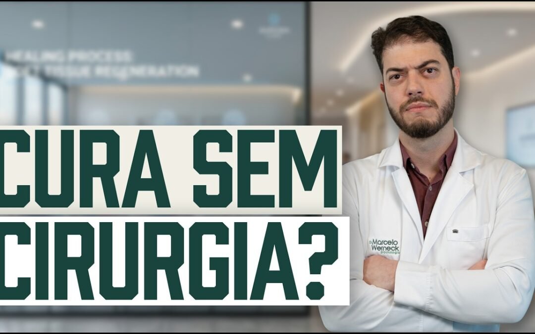 Tratamento de Fissura Anal no Consultório: Botox e Laser