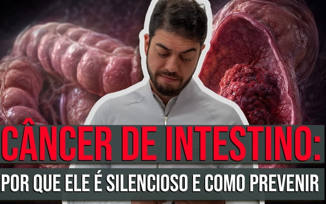 Pólipo Intestinal Pode Virar Câncer? Entenda a Evolução ao Câncer de Intestino