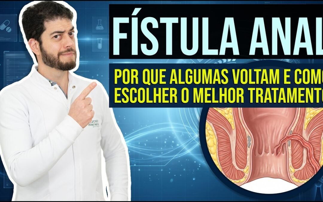 Tratamento da Fístula Anal: Tipos e Técnicas Modernas