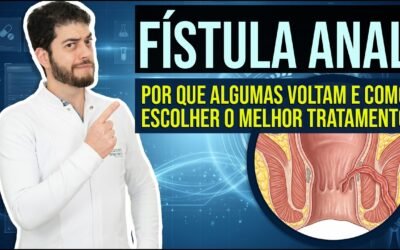 Tratamento da Fístula Anal: Tipos e Técnicas Modernas