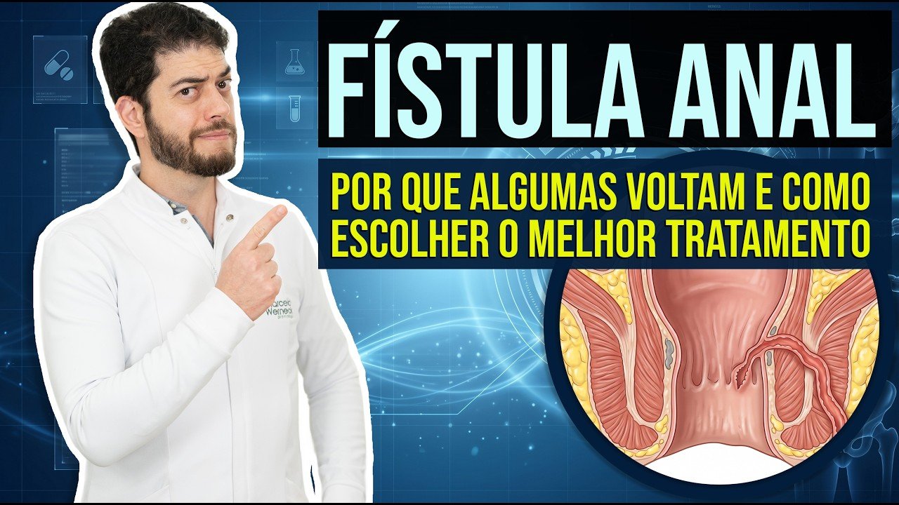 tratamento da fístula anal: técnicas modernas